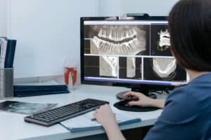 Digital Smile Design: Revolutionizing Cosmetic Dentistry