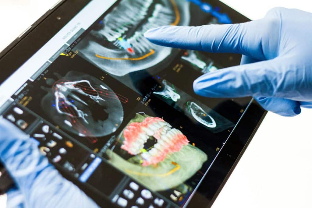 Digital Smile Design: Revolutionizing Cosmetic Dentistry