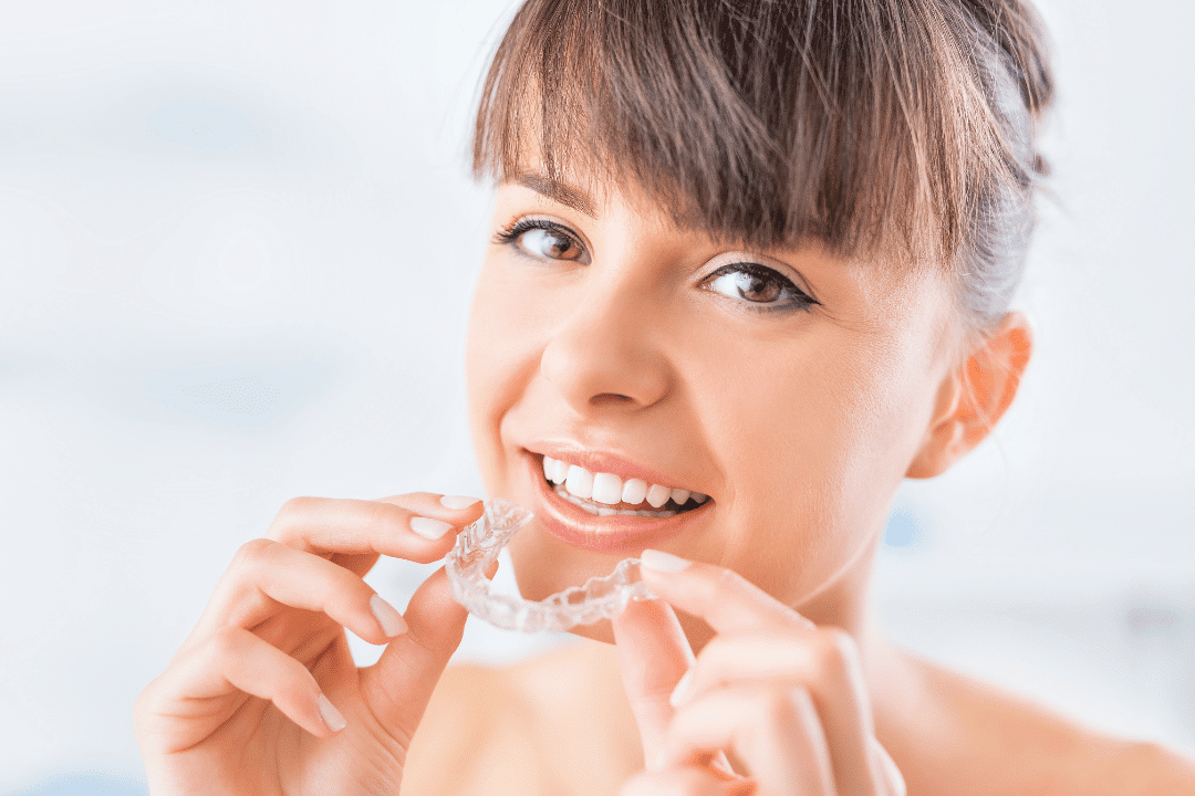 Invisalign clear aligners rockville