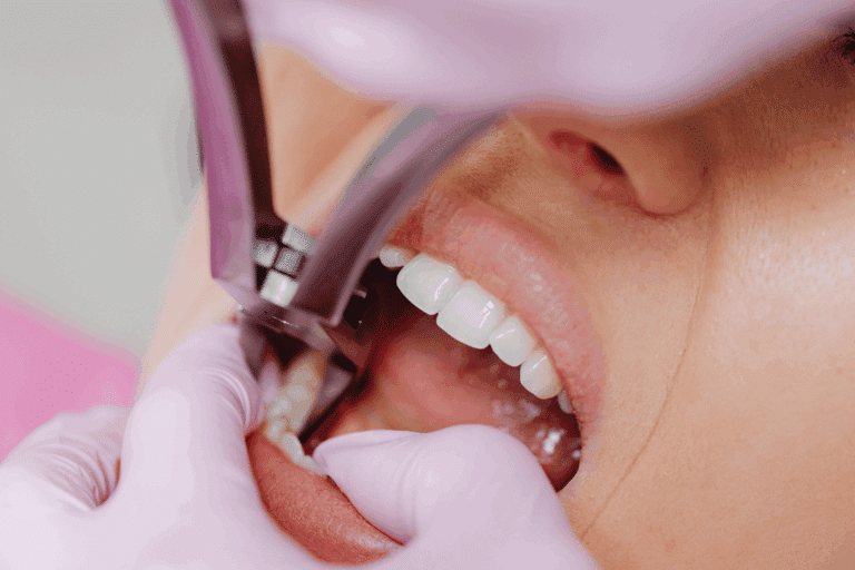 dental team preparing for extraction rockville