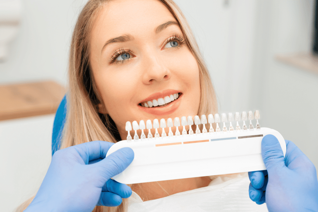 dental veneers rockville