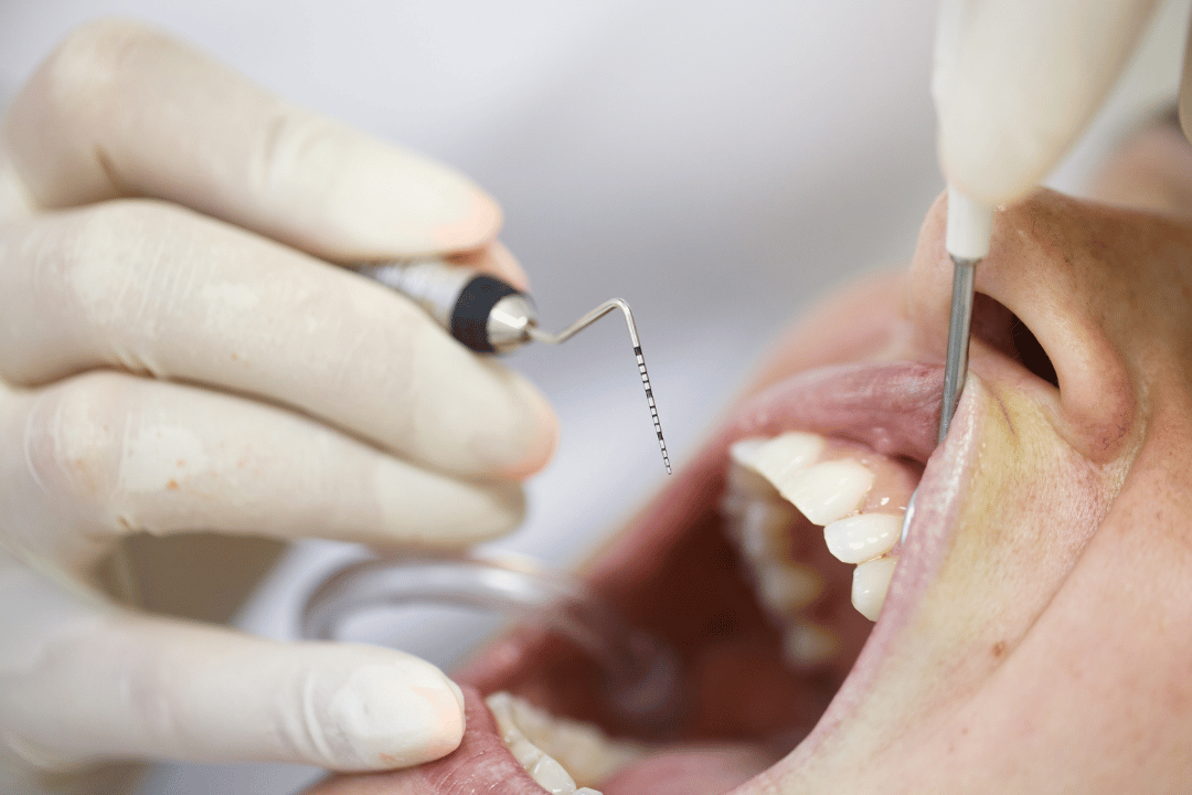 periodontal treatment rockville