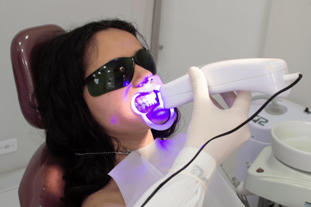 teeth whitening rockville