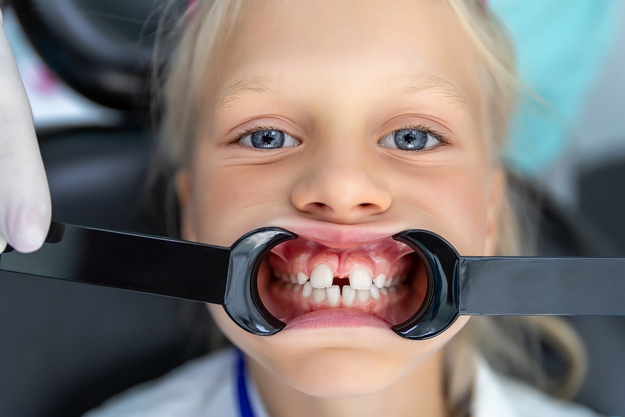 Child having her teeth examined during a dental visit